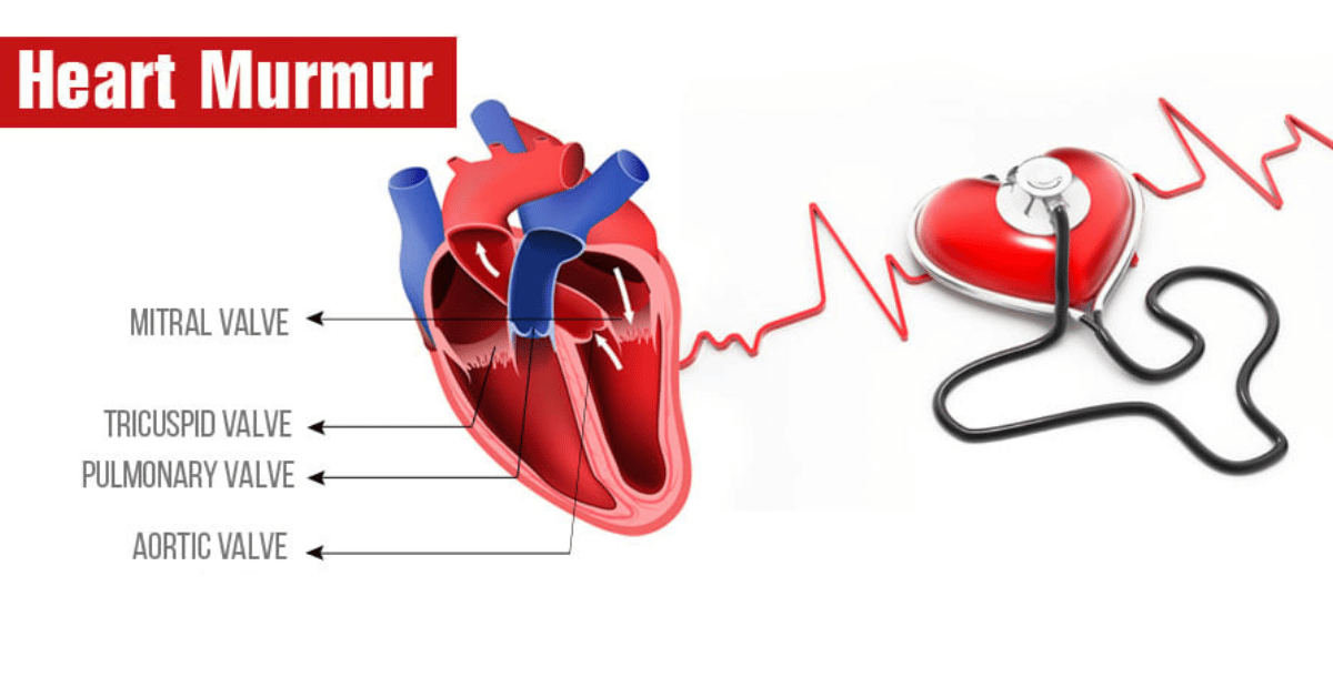 Heart Murmur Symptoms & Care at Bombay Hospital Mumbai