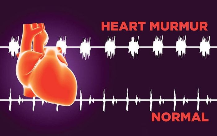 heart murmur diagnosis in Mumbai